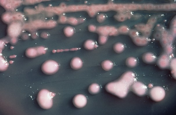 Centers for Disease Control and Prevention/Associated Press: It is one form of CRE bacteria, sometimes called “nightmare bacteria.” CRE bacteria is blamed for 600 deaths each year, and can withstand treatment from virtually every type of antibiotic.